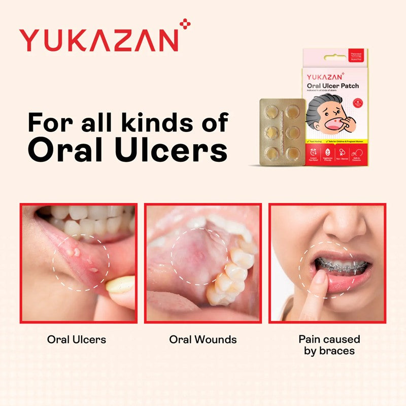 Oral Ulcer Patch 6s