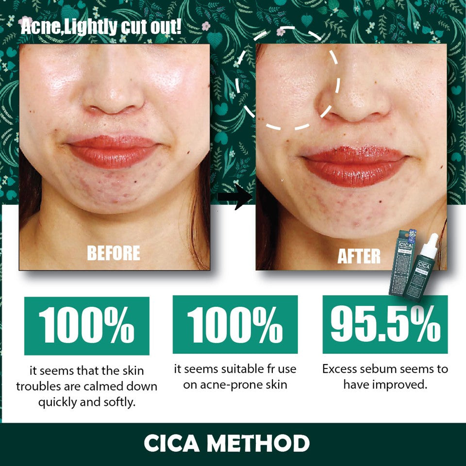 CICA METHOD Booster Serum 28ml | Isetan KL Online Store