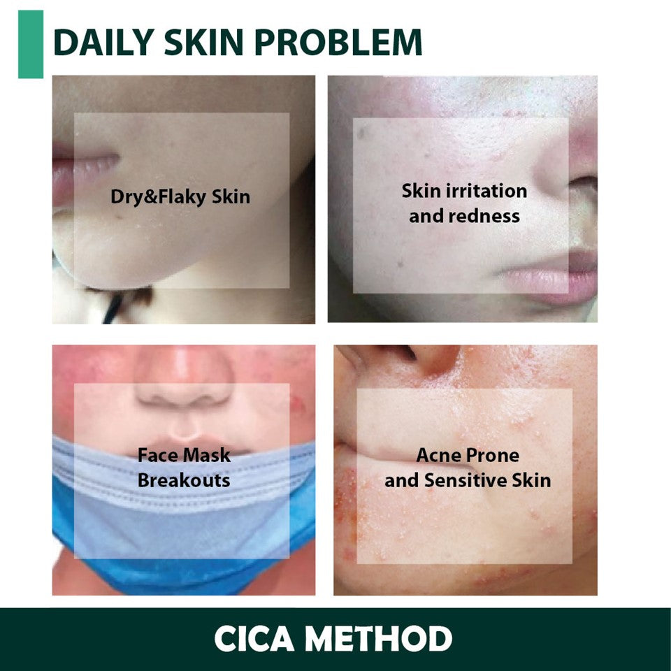 CICA METHOD Cream 50g / 100g | Isetan KL Online Store